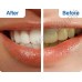 Отбеливающие полоски для зубов CREST WHITESTRIPS 3D